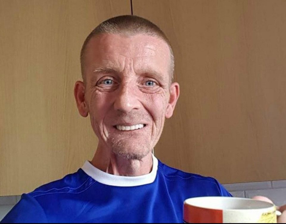  James Upfield, 46, has lost half his tongue to cancer, but still can't give up smoking