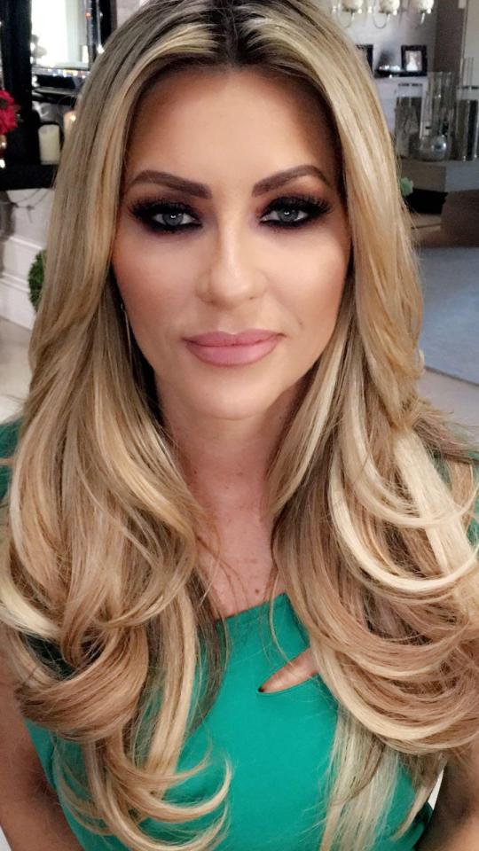  Real Housewives of Cheshire star Dawn Ward has revealed the results of her full facelift to The Sun Online