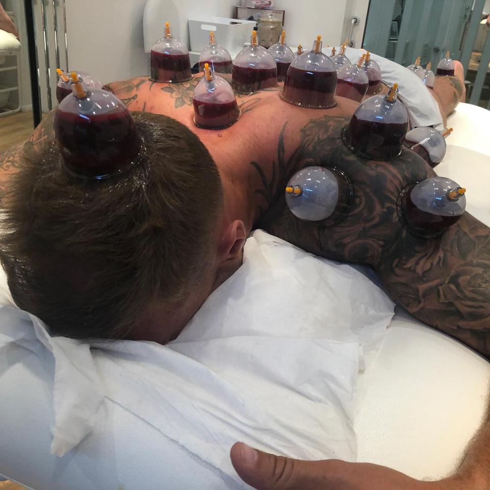  Calum Best tried it out on his back and head