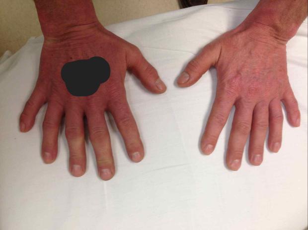 Can you spot what is wrong with this man's hands?