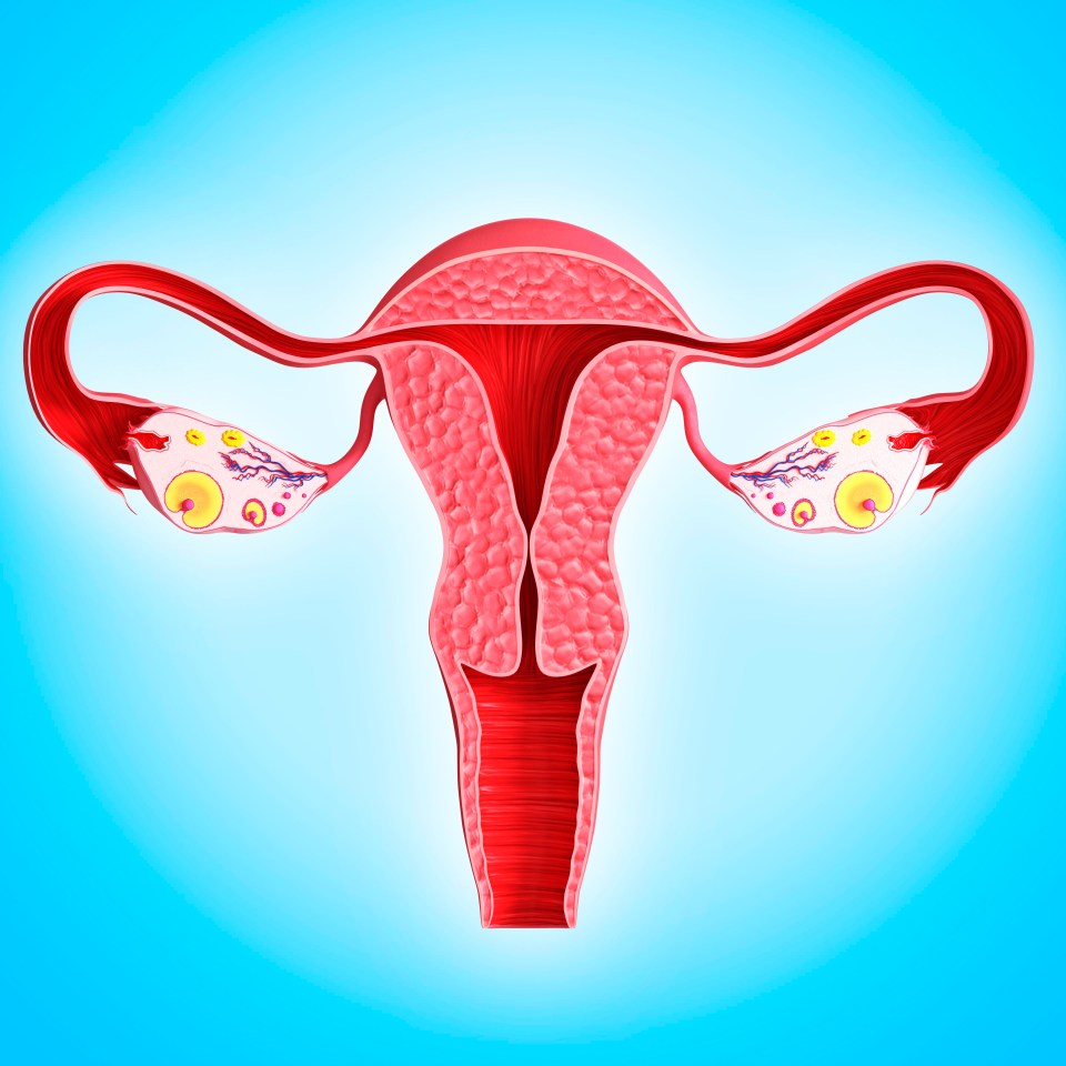 If the tissue surrounding a woman's ovary is not developed properly then a woman is unable to release an egg during her monthly cycle