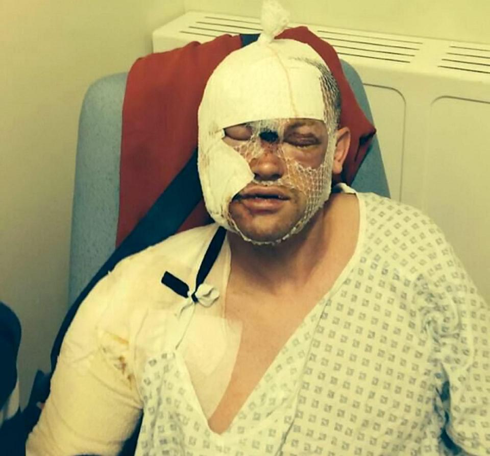  He was left in agony after being squirted with acid through open driver's window