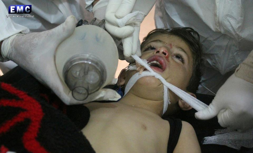  A child is treated in hospital after the attack in Khan Sheikhoun