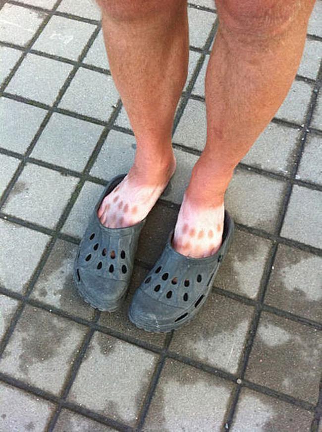 If Crocs weren’t already criminal enough, this fashionista failed to think about his tanlines