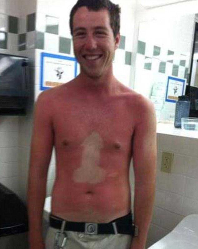 If there was an award for the most embarrassing tanning fail, this man would win first prize