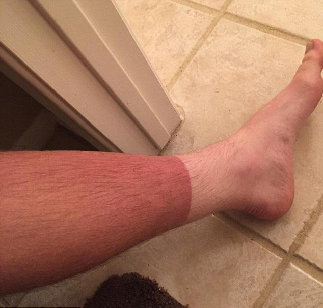 We’ve all heard of a T-shirt tan… but what about this SOCK tan?