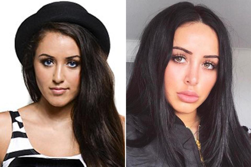  Marnie when she started Geordie Shore (L) and after first nose job