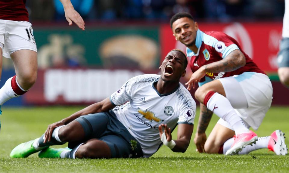  Paul Pogba is injured with a muscle problem sustained against Burnley