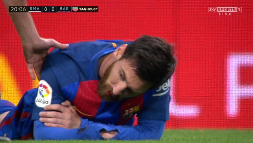 Messi was cut and struggling on the floor