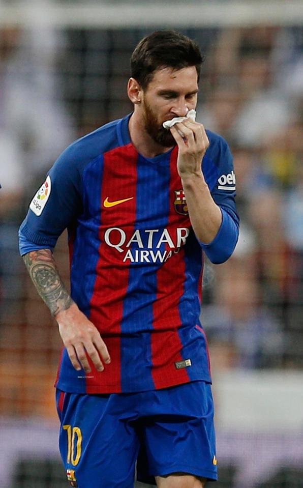 Lionel Messi refused to let a head injury stop him, and scored his side's first goal during El Clasico