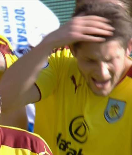  James Tarkowski was the unlucky player who was hit square on the head by the lighter