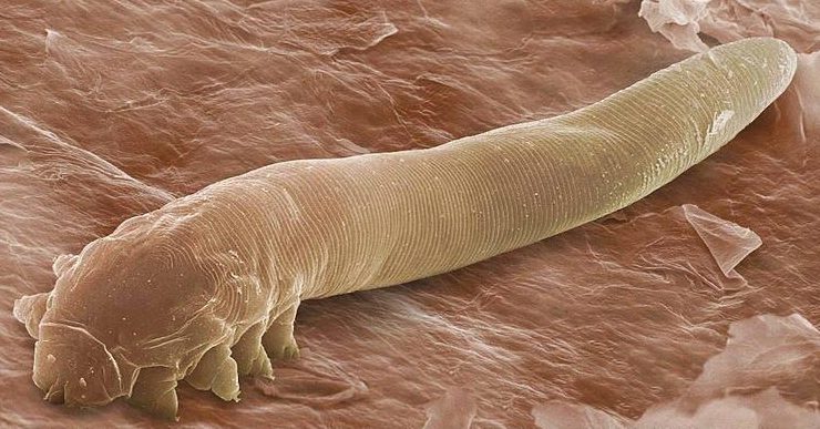 There are thousands of microscope mites living on our face, pictured demodex folliculorum