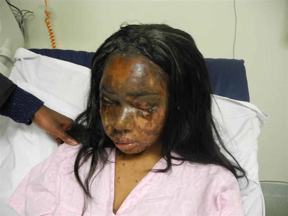  Naomi's attacker disguised herself with a headscarf to douse her face in acid