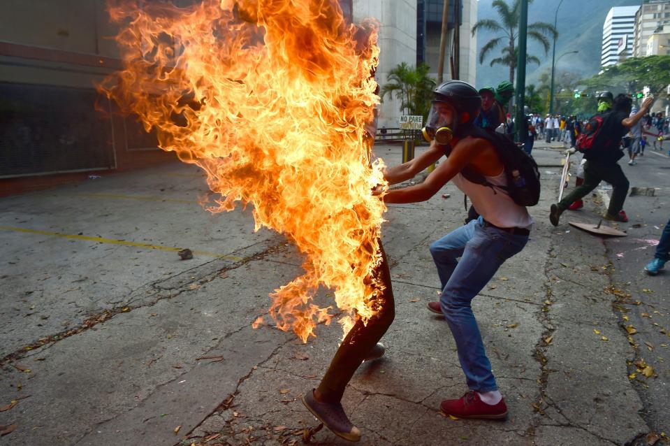  Fellow protesters helped extinguish the flames and got him medical aid