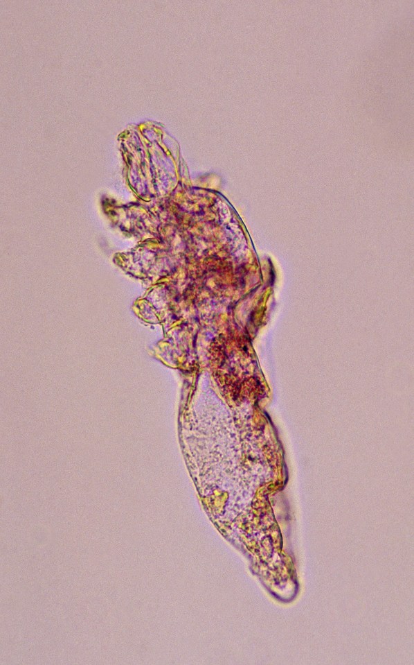 The mites have a head, four pairs of legs and an elongated body