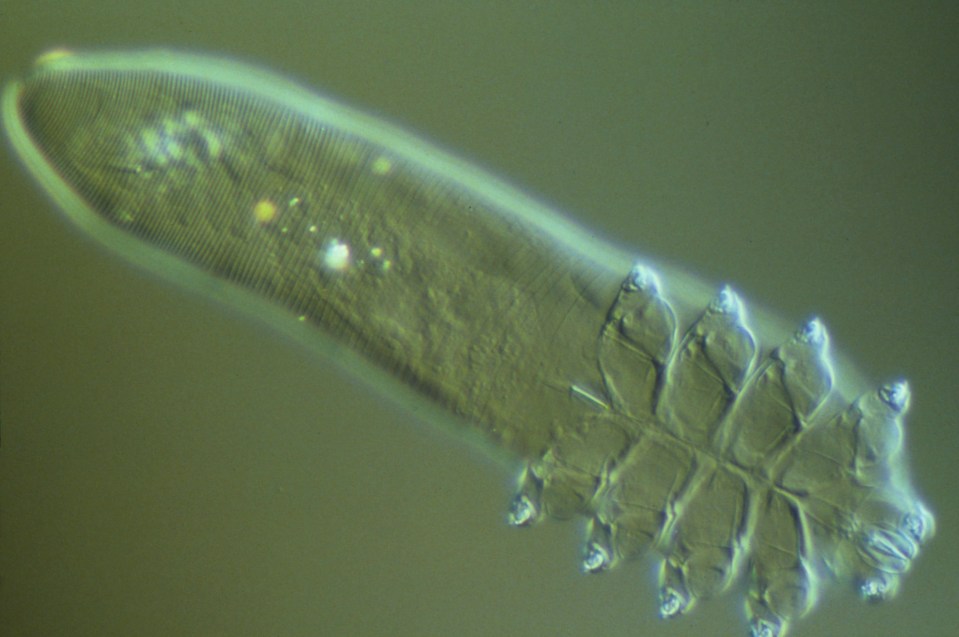 Demodex folliculorum, pictured, are commonly found around the cheeks, nose, eyebrows, eyelashes and forehead