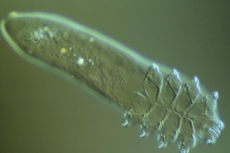  Demodex folliculorum, pictured, are commonly found around the cheeks, nose, eyebrows, eyelashes and forehead