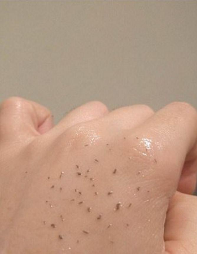  Experimental beauty addicts have been using the unconventional method to extract their blackheads