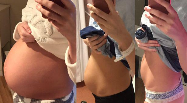  Chloe's photos document the changes she underwent after giving birth