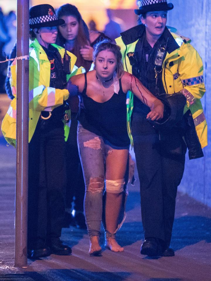  An injured woman is escorted from the arena by police after loud bangs were heard at the gig