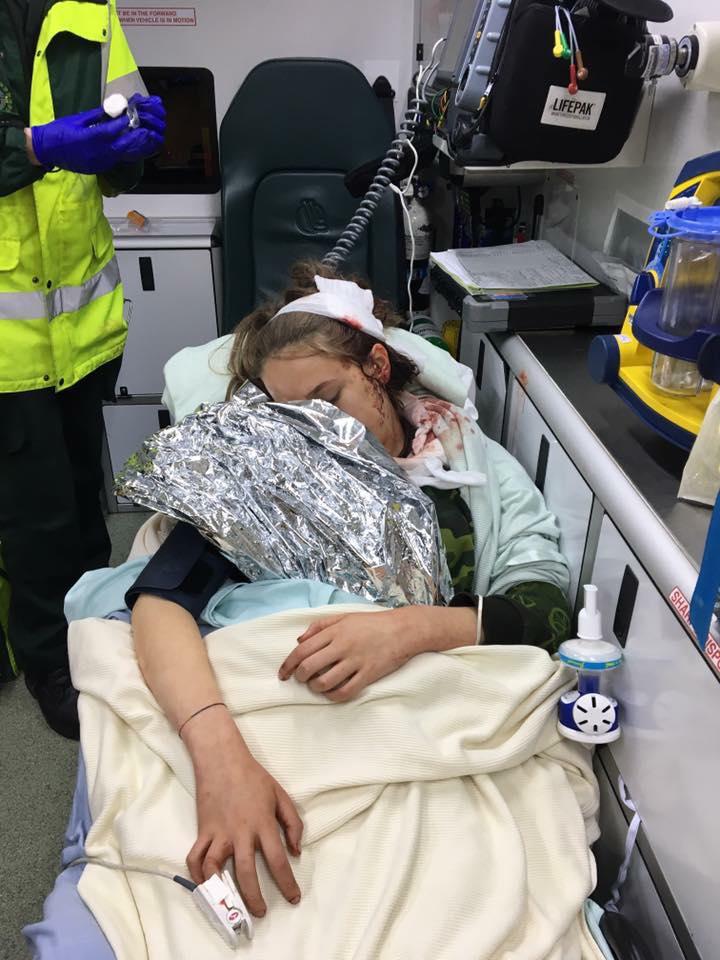  Craig Mills shared this picture of his daughter Evie after she was hurt in the Manchester attack