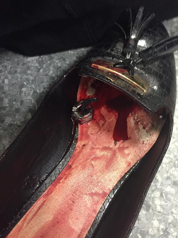  Lisa's shoe was left covered in blood and shrapnel following Monday's atrocity