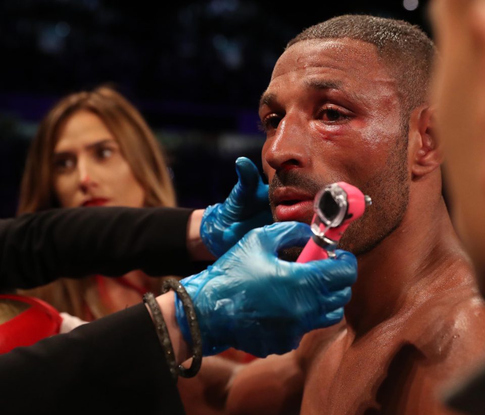  Kell Brook is examined by the doctor after his stoppage in Sheffield