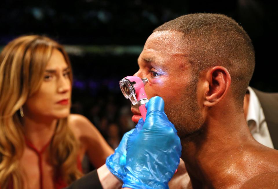  Kell Brook suffered a fractured eye socket once again in his defeat to Errol Spence Jr