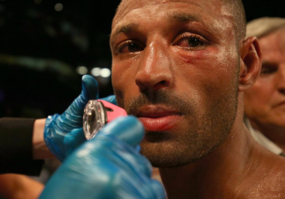  Kell Brook has confirmed he has broken his eye socket again and will need another operation to repair the injury