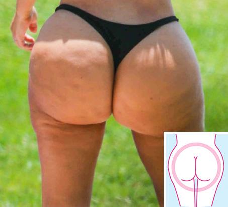  People with bums like Kim Kardashian are outgoing