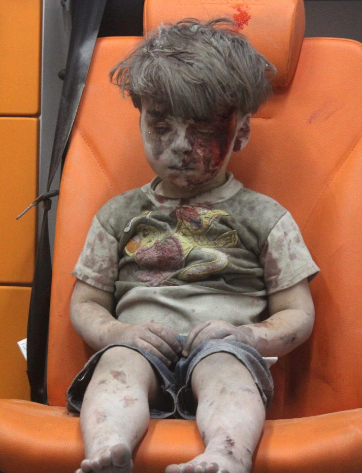  The little boy became a symbol of the horrors of the Syrian civil war