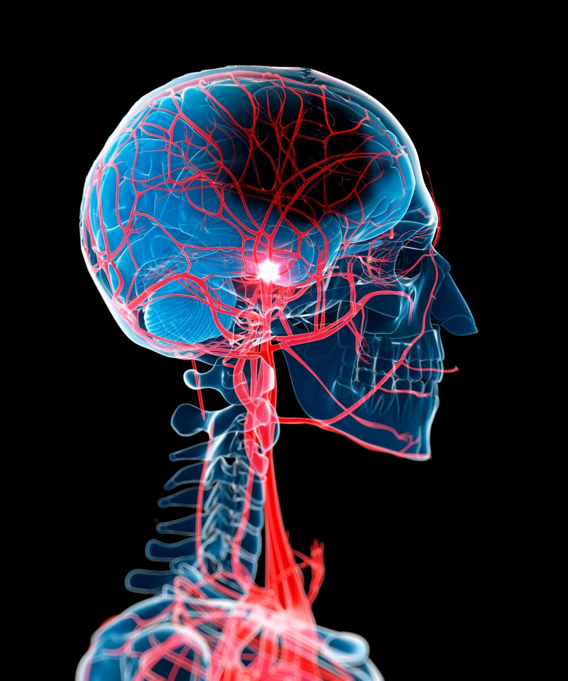 Saturated fats have also been linked to stroke as clogged arteries can block the blood supply to the brain