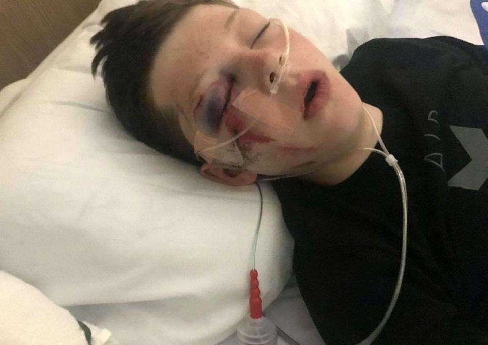  Schoolboy Jack Beckett, 12, was left with horror injuries after he was thrown from a fairground ride