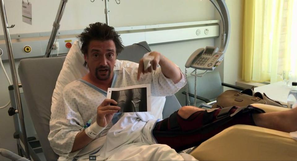  The Grand Tour presenter recovers in hospital following the smash