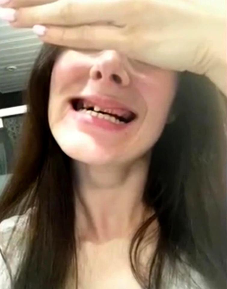  Anastasia shows off her damaged teeth after undergoing the brutal and unnecessary treatment