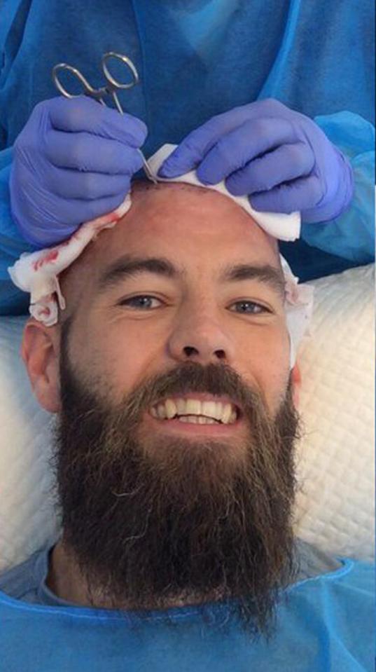  Wales midfielder Joe Ledley smiles during his hair treatment