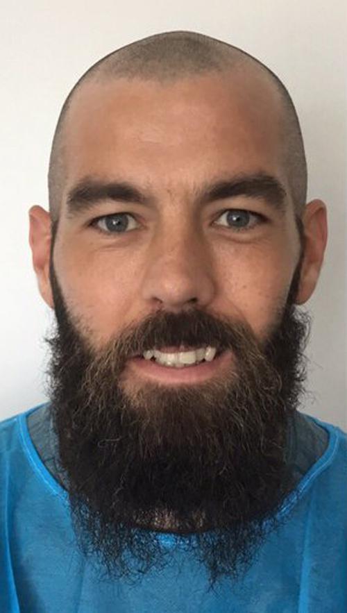  Joe Ledley had his head shaved by KSL Hair ahead of his treatment