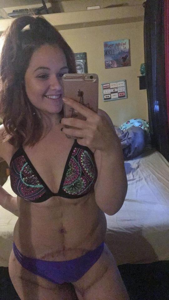  Kylie now weighs a slender 11 stone and has now bought her first bikini for summer