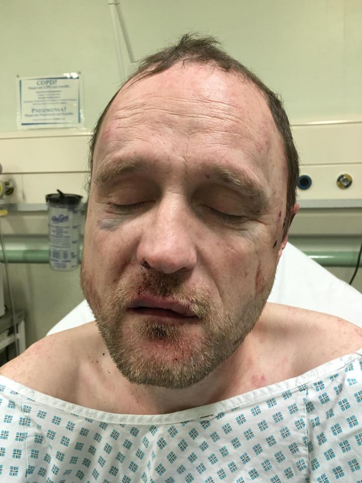  Simon Clarke was left in hospital after being attacked by a gang of 35 people outside his home