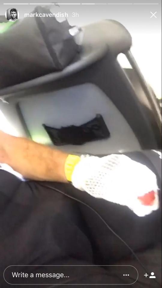  Mark Cavendish was left with a bloodied hand after the crash