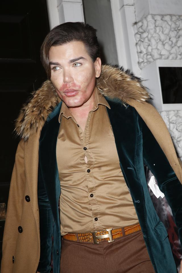  Depression has caused Rodrigo Alves to over eat - and now his designer clothes are bursting at the seams