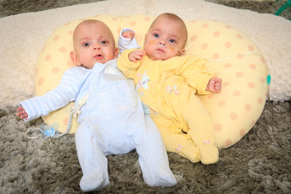 Twins Albert (left) and Molly (right) have beaten the odds to stay alive despite being born at 23 weeks 