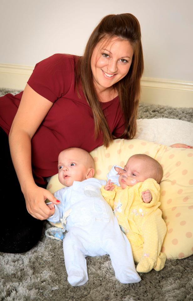  She also said every doctor she has come across has told her 'count her lucky stars' after her twins defied all odds