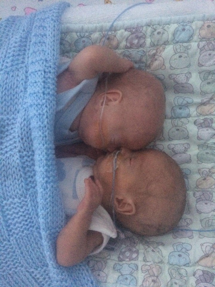 Twins Dolly (top) and Albert (bottom) aged three months old