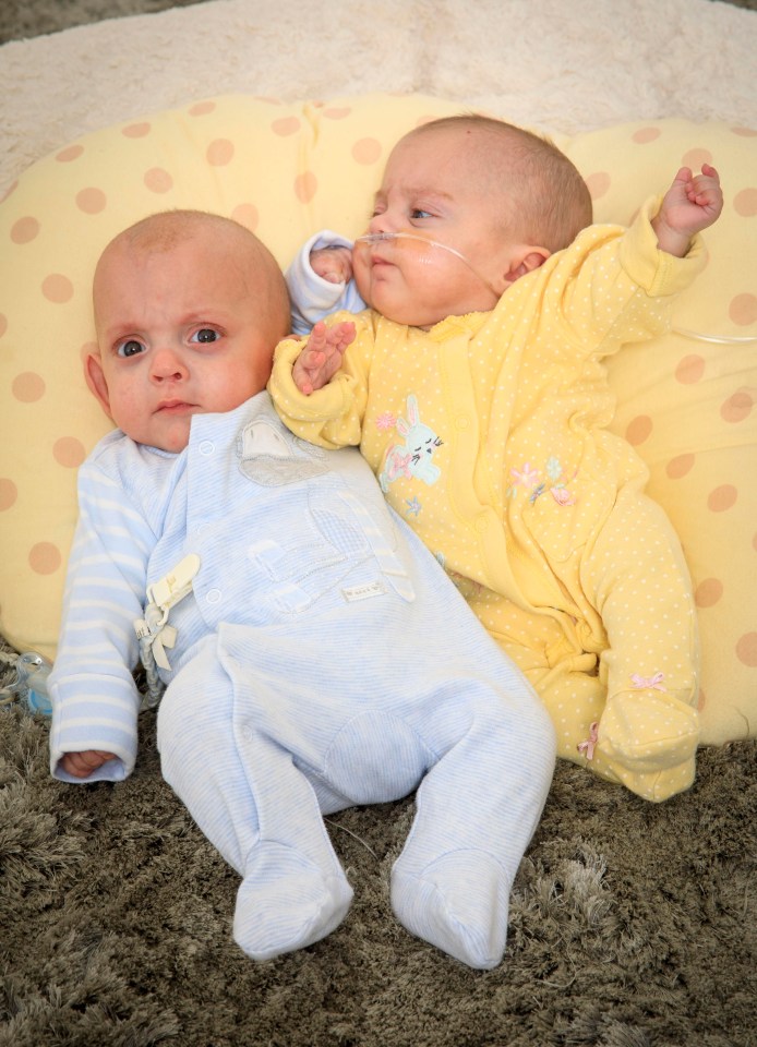 The twins are now living with their parents Shona and Darren