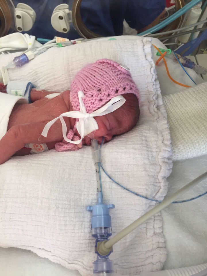 Dolly on a ventilator aged six week after heart surgery 