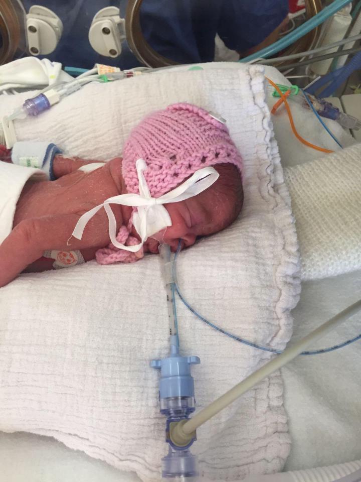  Dolly on a ventilator aged six week after heart surgery