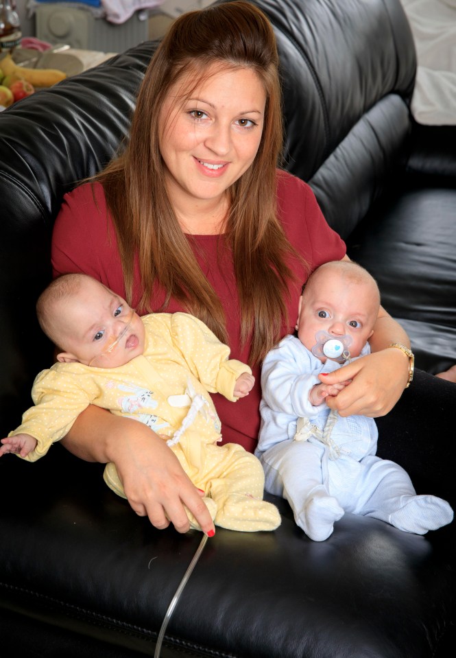 Medics told Shona it was exceptionally rare for twins to arrive so far apart 