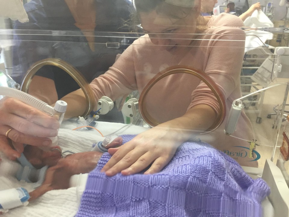 Albert aged four days old with the ventilator at Brighton Hospital