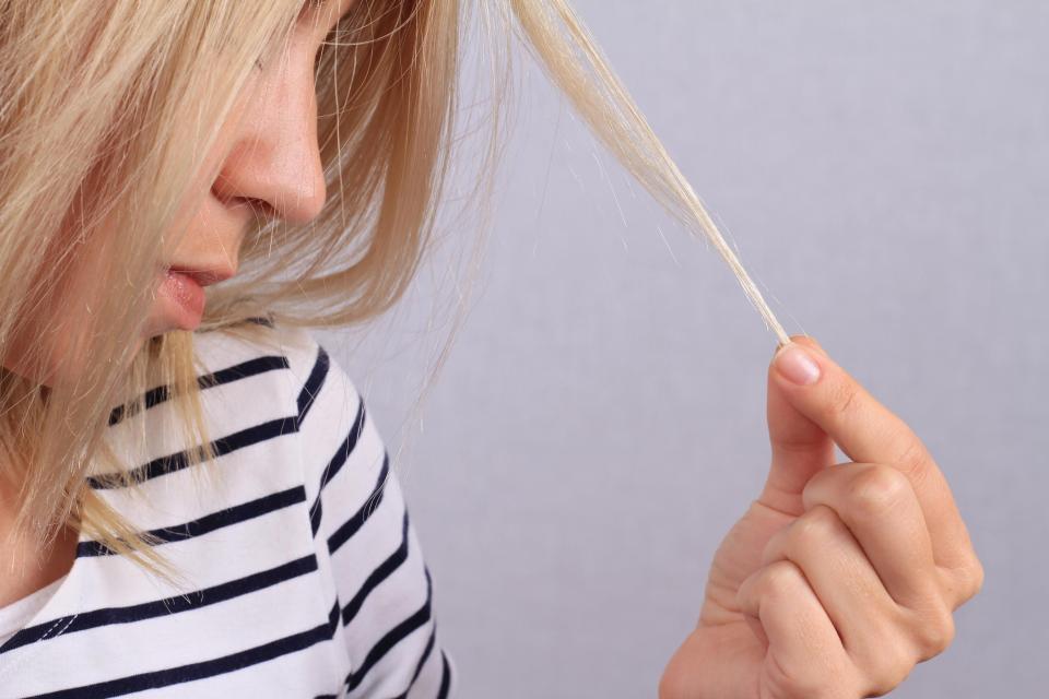  Thinning hair can be an issue at any age but will get worse as you get older